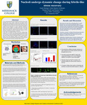 Nucleoli undergo dynamic changes during febrile-like stress recovery by Giulia Martins Cavalcante, Brianna Vesey, Kaéla Harrigan, Kailey Leclerc, and Shania Polanco