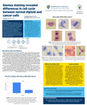 Giemsa staining revealed differences in cell cycle between normal diploid and cancer cells by Dalia Silva