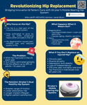 Revolutionizing Hip Replacement: Bridging Innovation & Patient Care with Stryker’s Mobile Bearing Hip System by Allie Lahiff